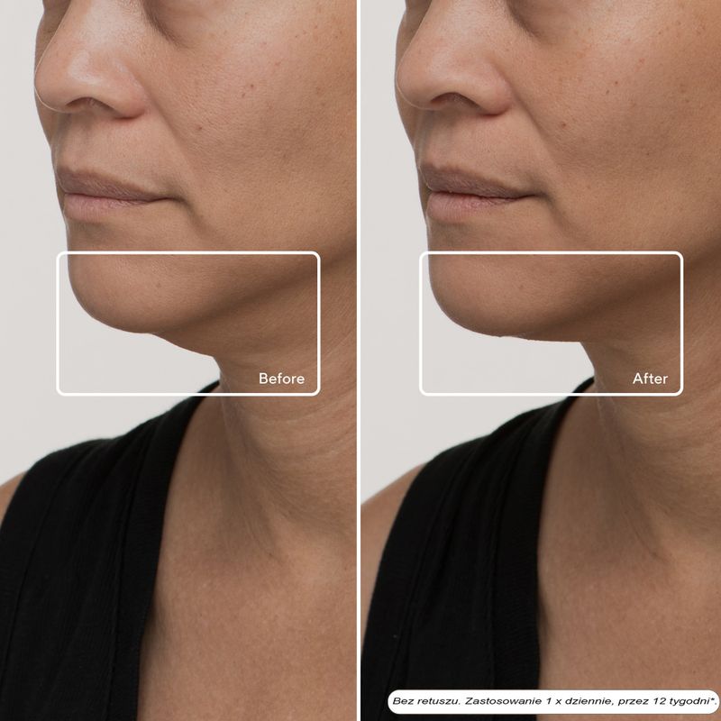 Arc LED az arcra Therabody TheraFace LED Mask 9