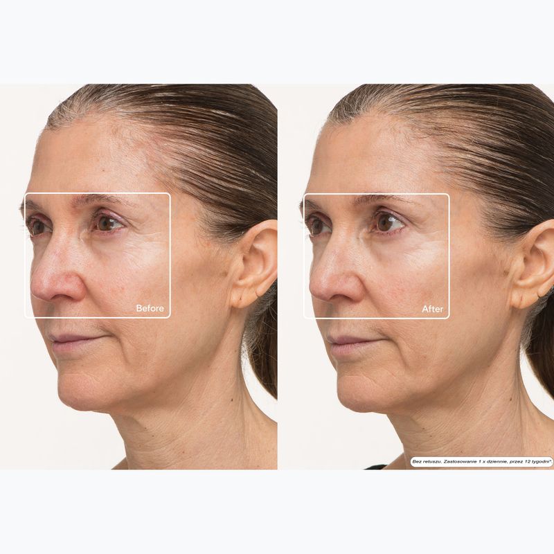 Arc LED az arcra Therabody TheraFace LED Mask 10