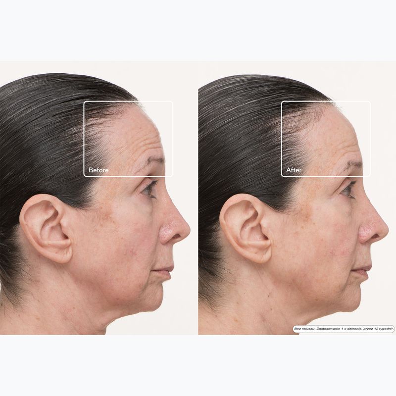 Arc LED az arcra Therabody TheraFace LED Mask 11