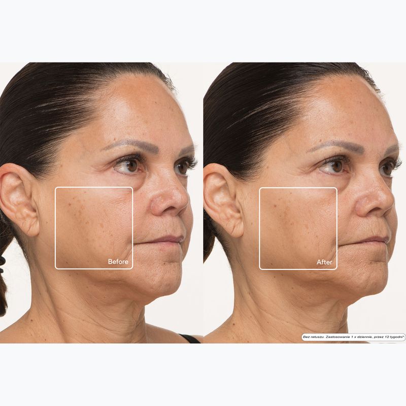 Arc LED az arcra Therabody TheraFace LED Mask 13